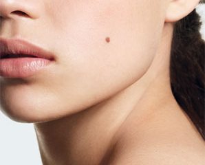 अगर आपके शरीर पर यहां तिल है तो आपको करोड़पति होने से कोई नहीं रोक सकता